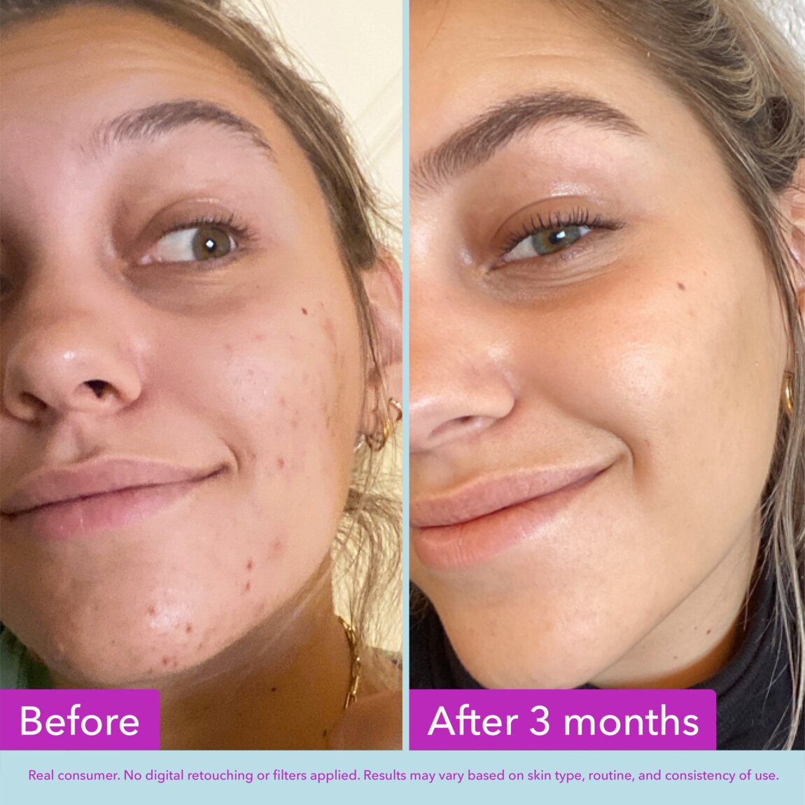 niacinamide-brightening-toner-v7 zb_p.jpg
