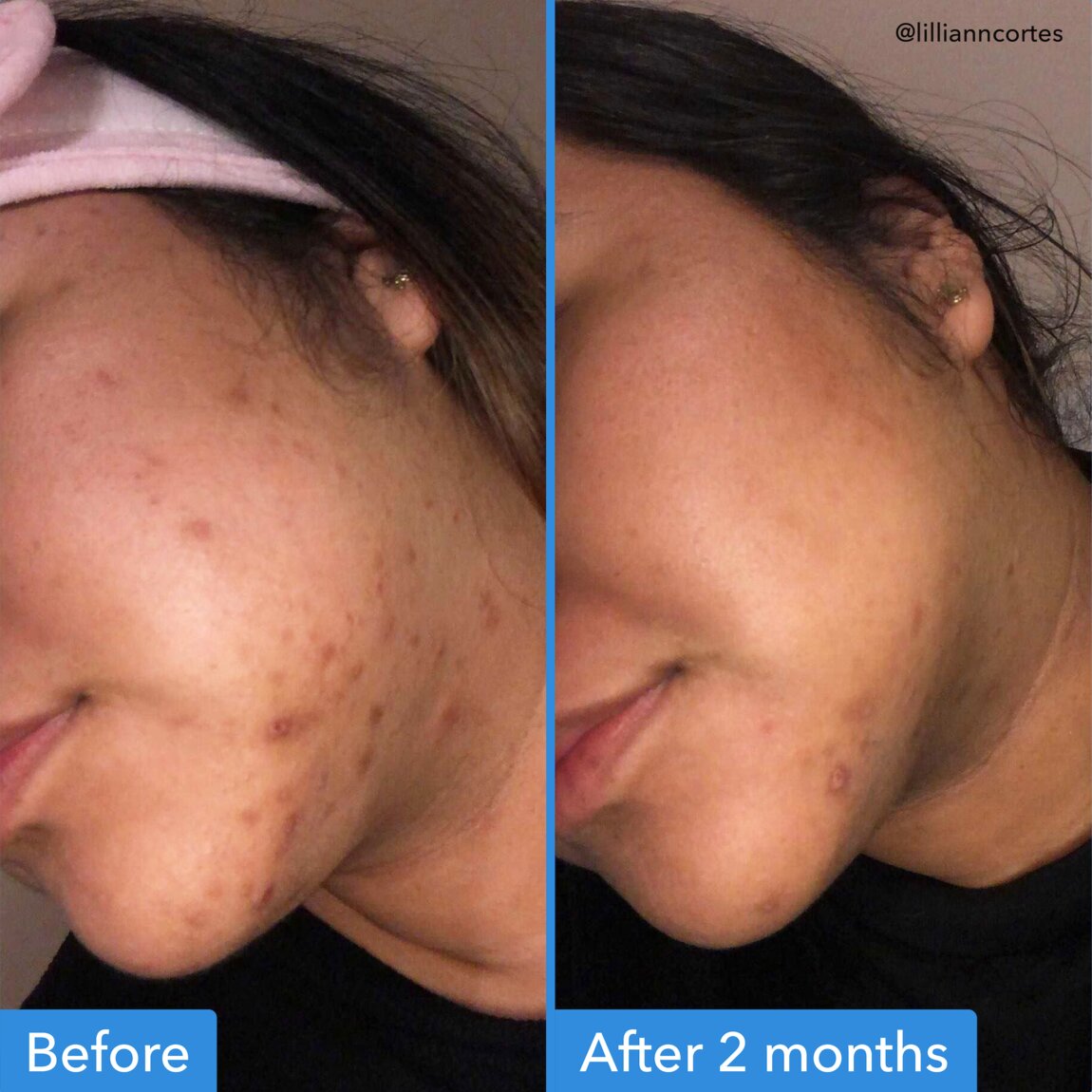 discoloration-correcting-serum-j8 zb_p.jpg