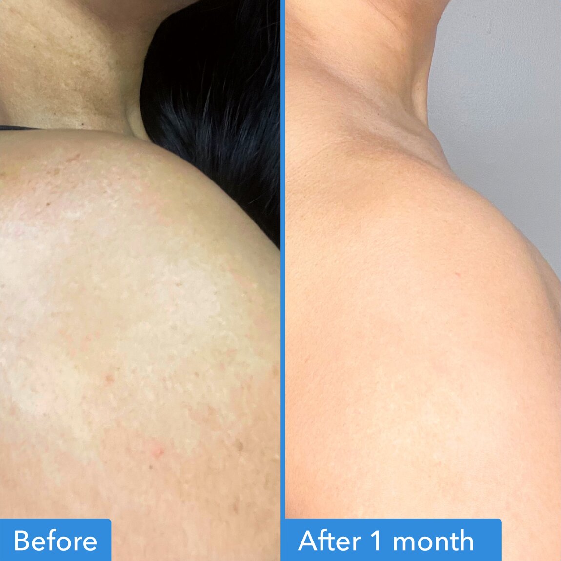 discoloration-correcting-body-treatment-o3 zb_p.jpg